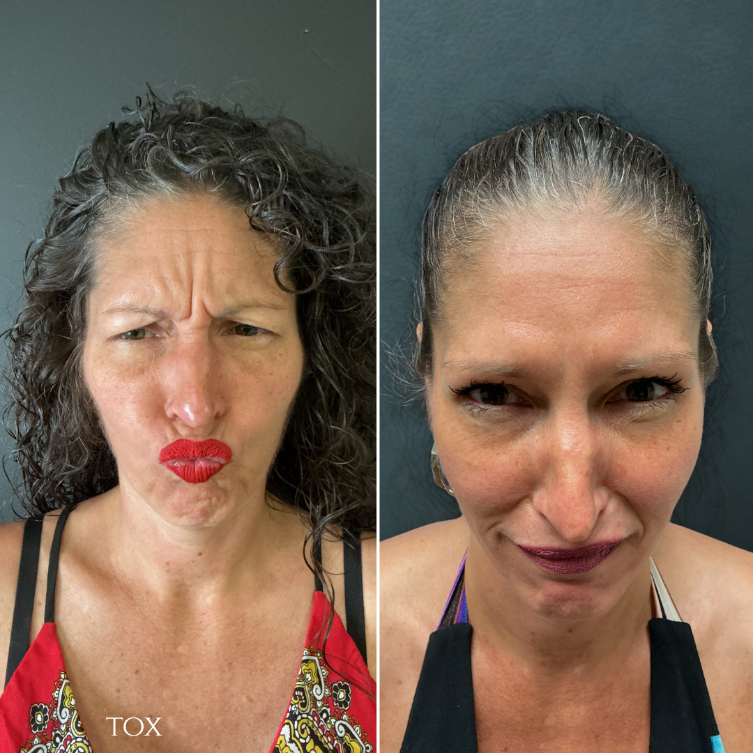 Side-by-side comparison. Woman with curly hair making a face then with smoothed hair and a different expression.