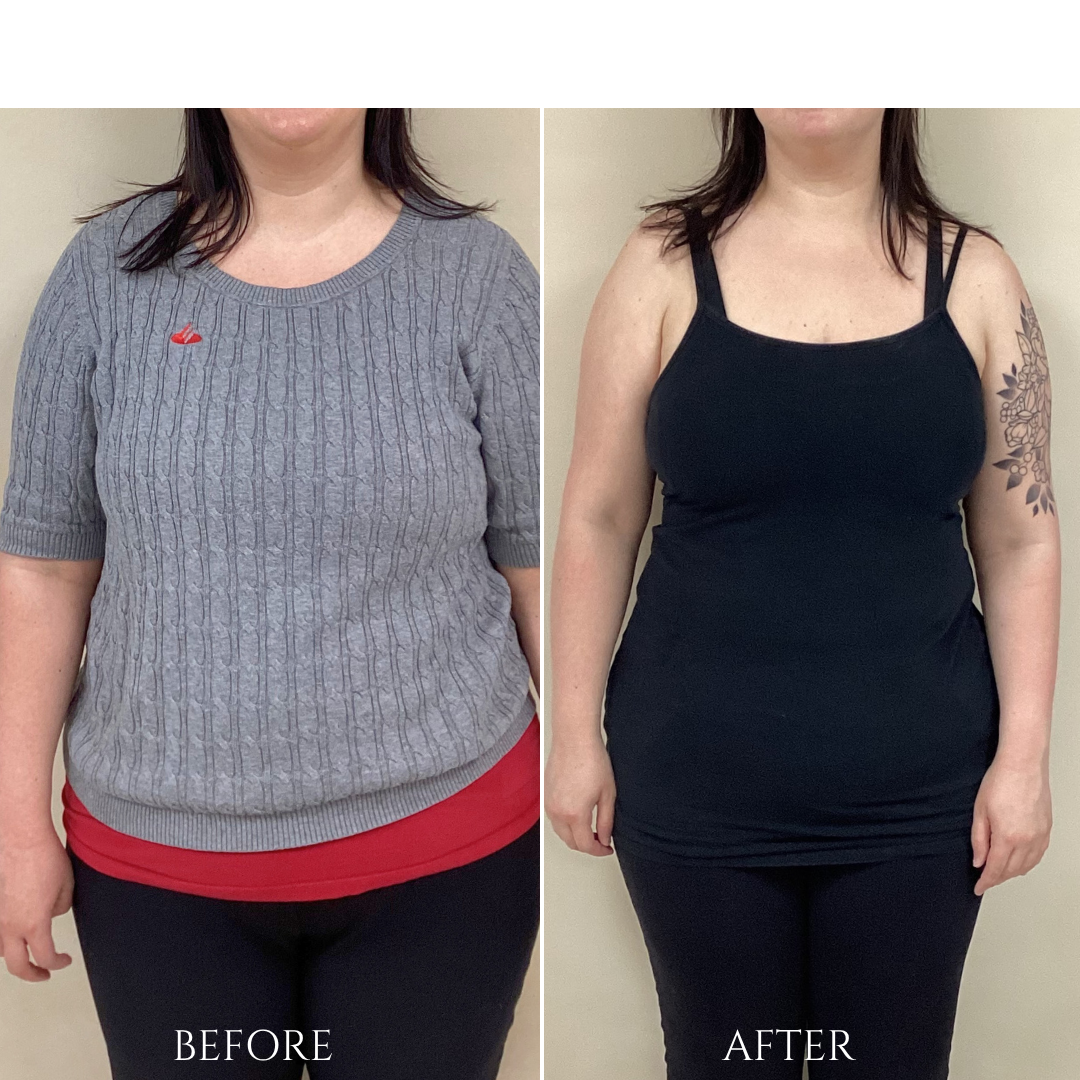 Side-by-side comparison. Woman in gray sweater before, black tank top after. Weight loss evident.