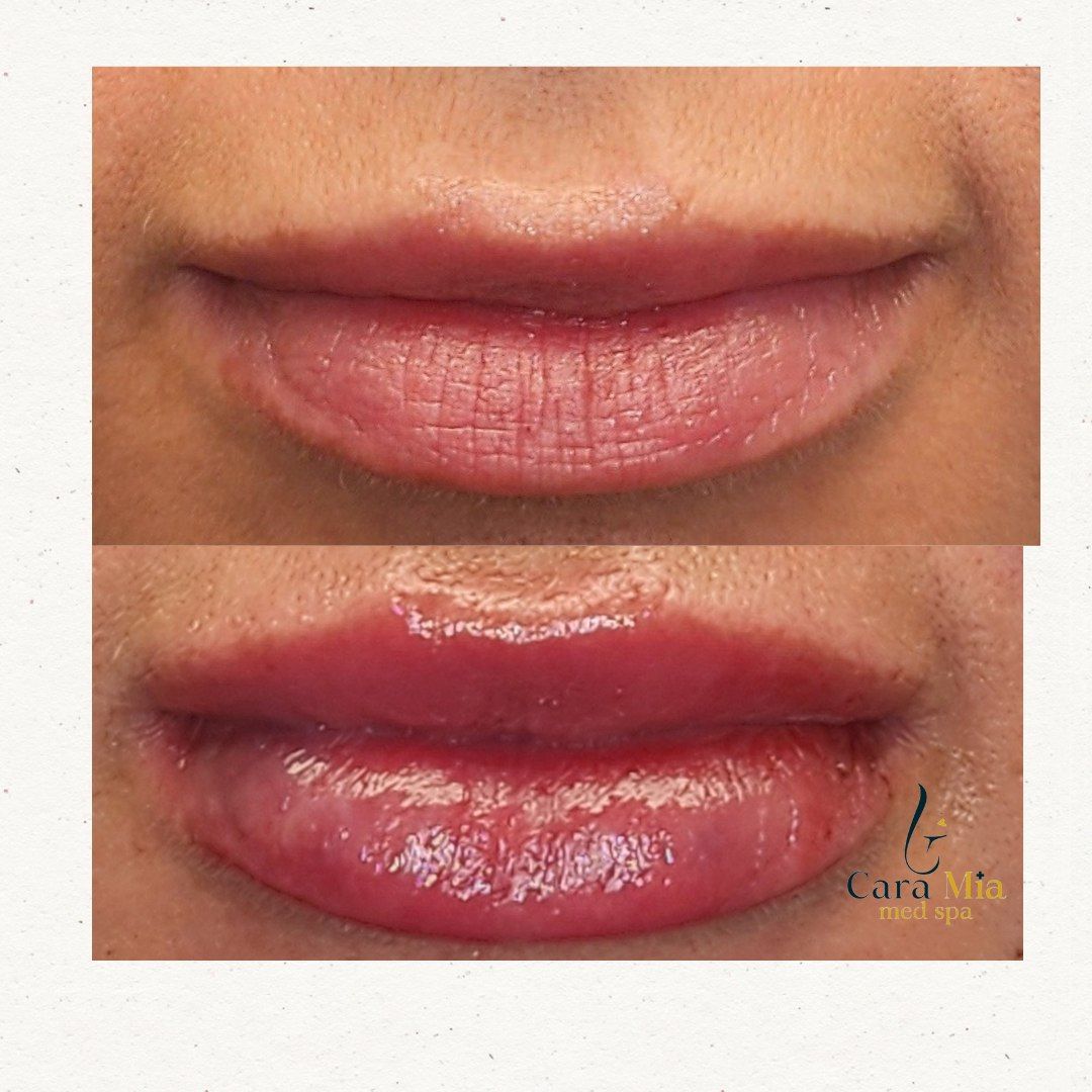 A before and after photo of a woman 's lips.