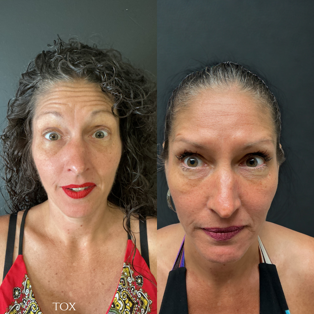 Side-by-side photos of a woman with red lipstick and curly hair, then with smooth skin and straightened hair.