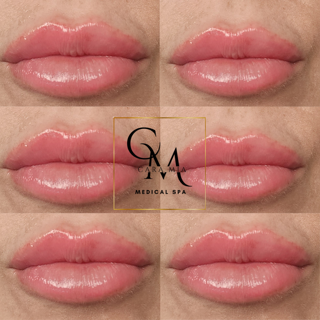 Six close-up views of full, glossy lips; medical spa logo in the center.
