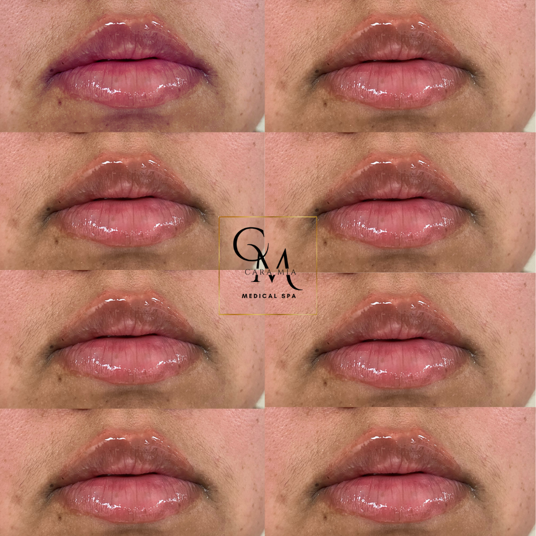 Eight close-up views of lips, varying in color from light to dark with a glossy shine.