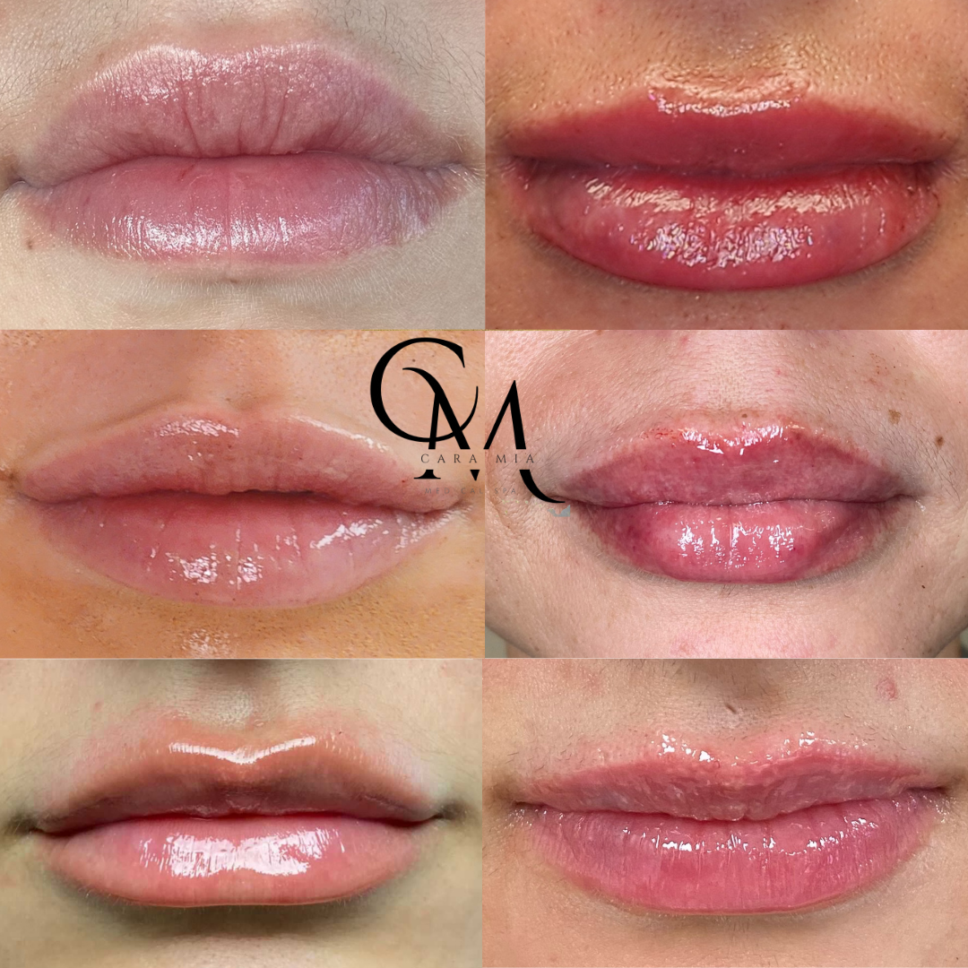 Six close-up views of plump, glossy lips in various shades of pink.