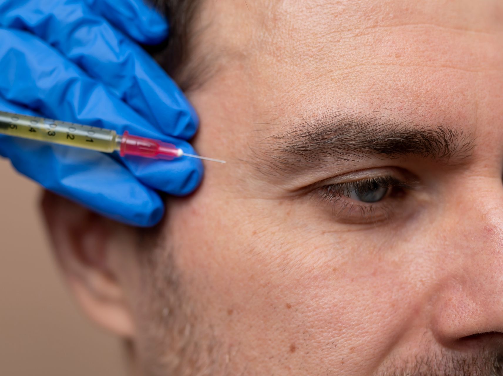 A woman is getting a facial treatment with a syringe.