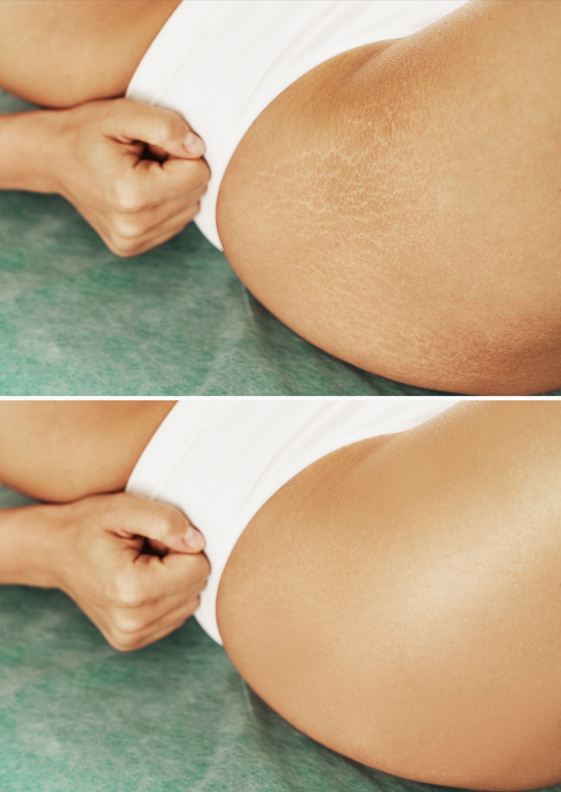 Two-panel comparison: a person's hand clenches into a fist to massage a buttock, before and after smoothing the skin.