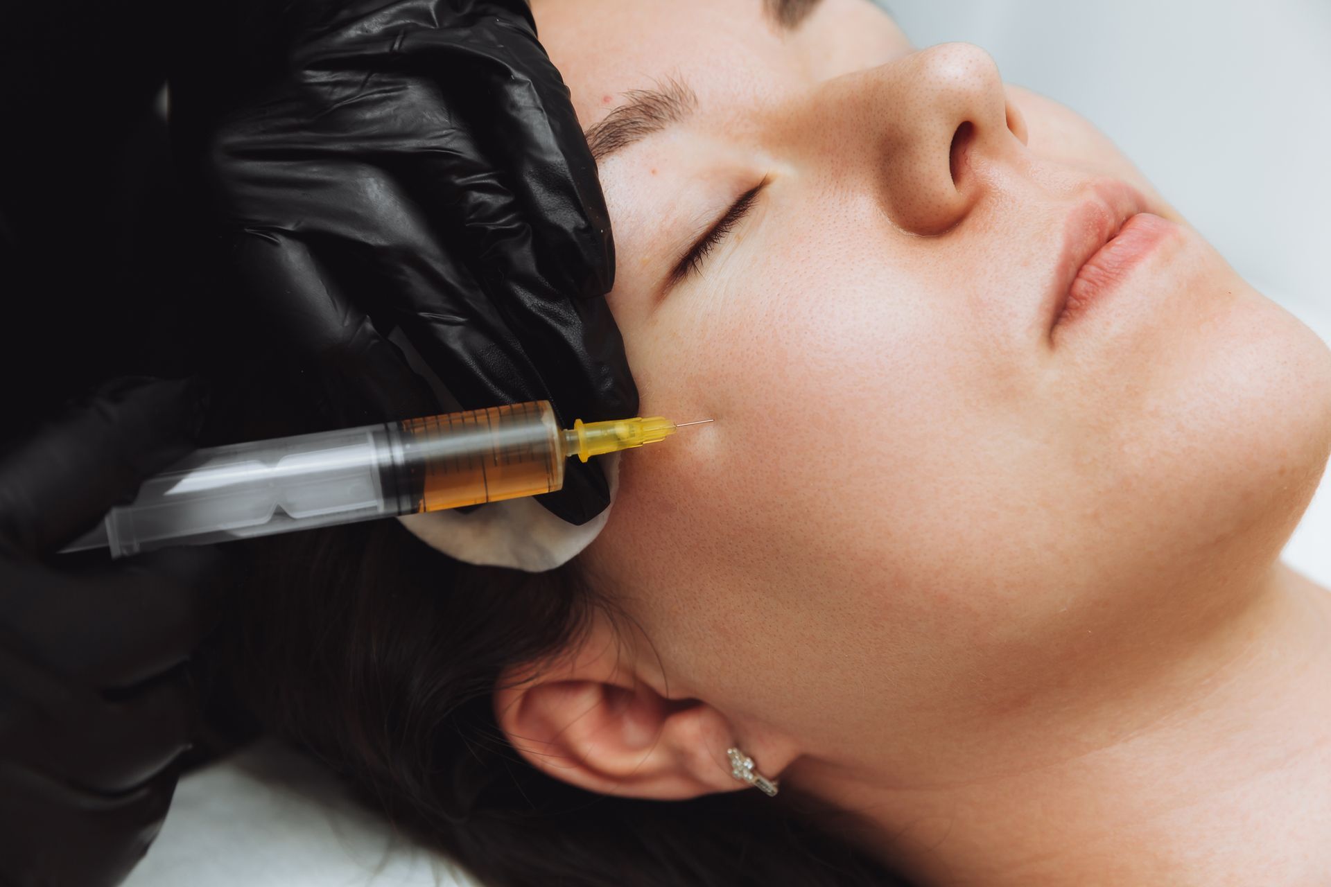 A woman is getting a botox injection in her face.