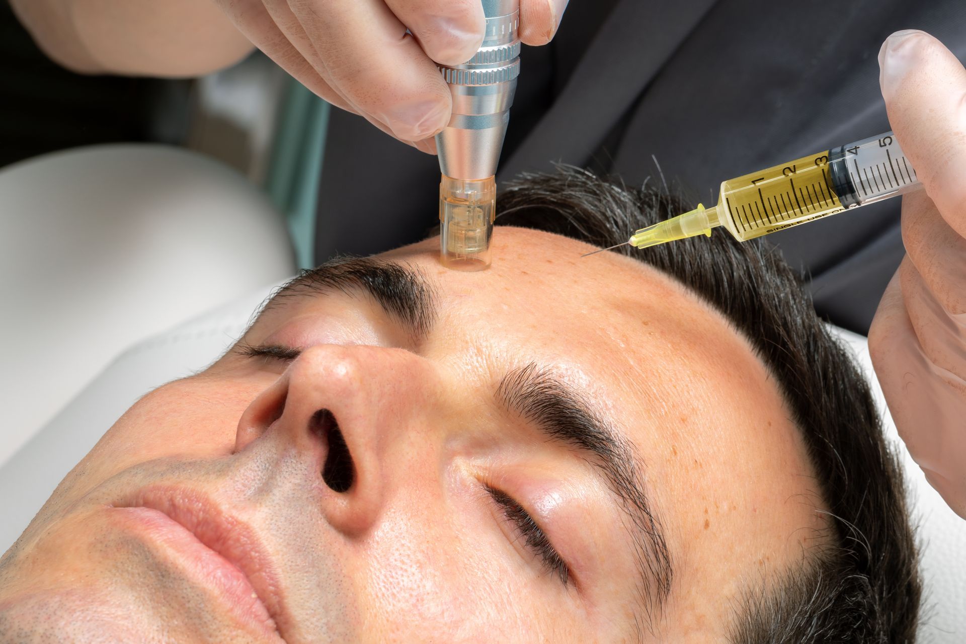 A man is getting a facial treatment with a syringe on his forehead.