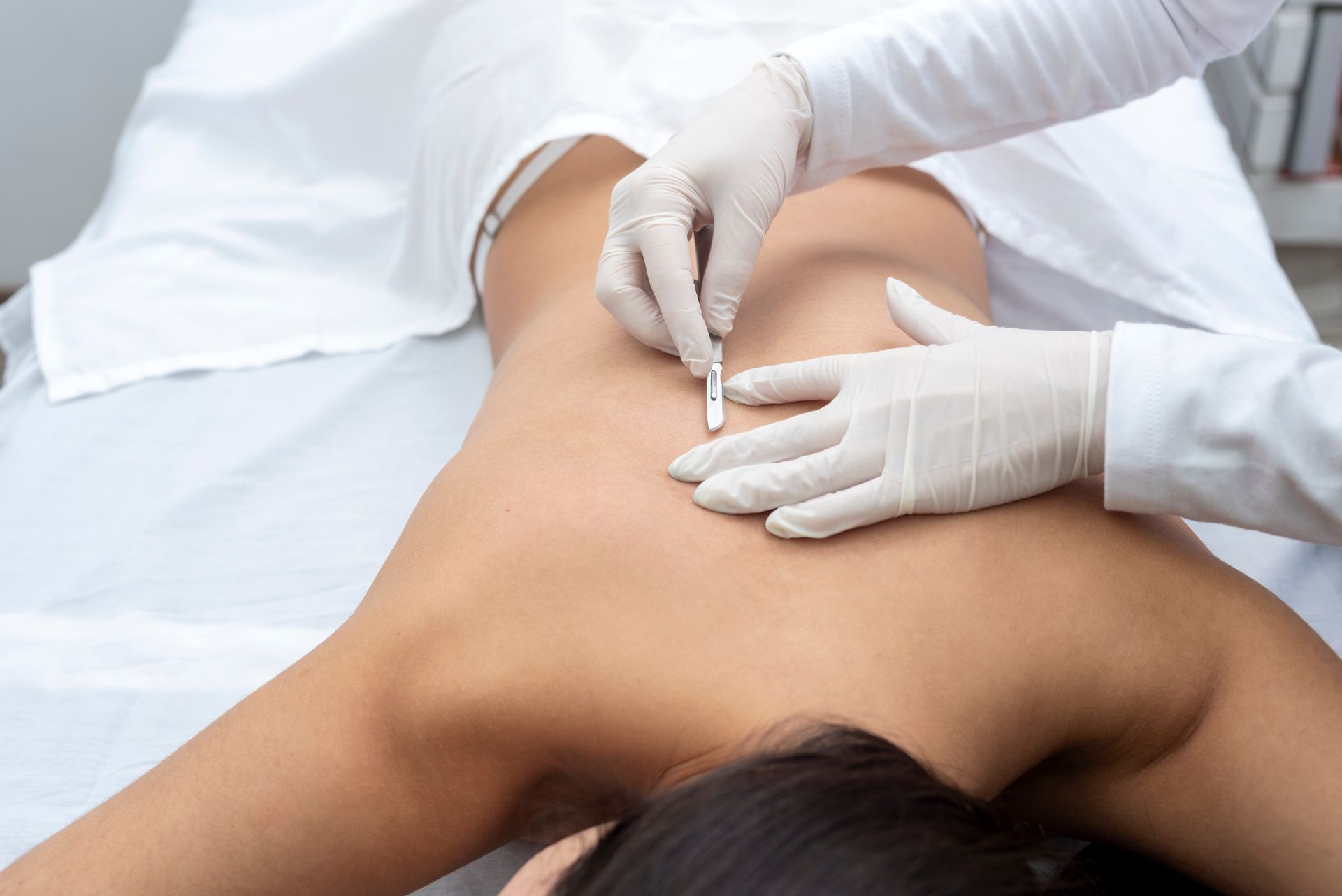 A woman is getting a laser treatment on her back.