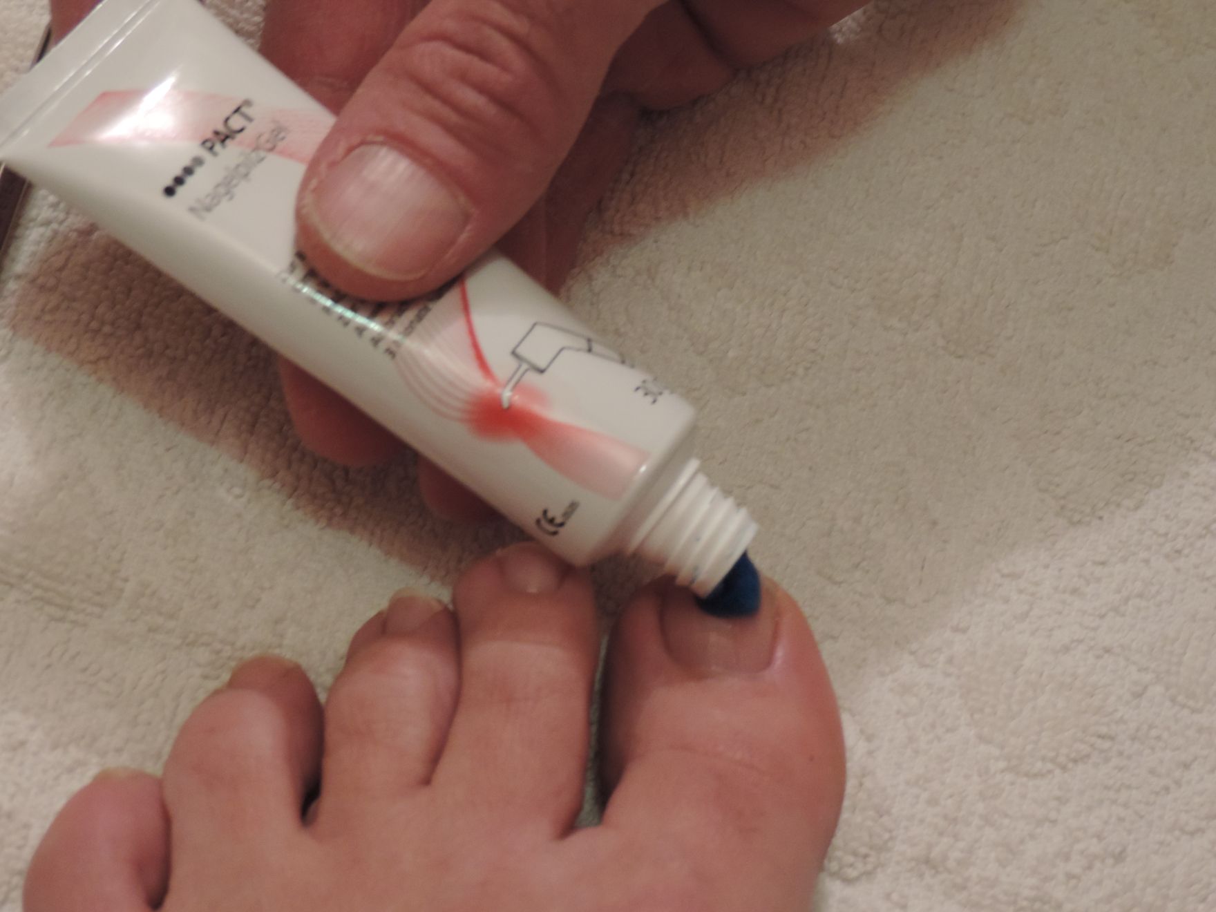 applicazione pomata contro micosi