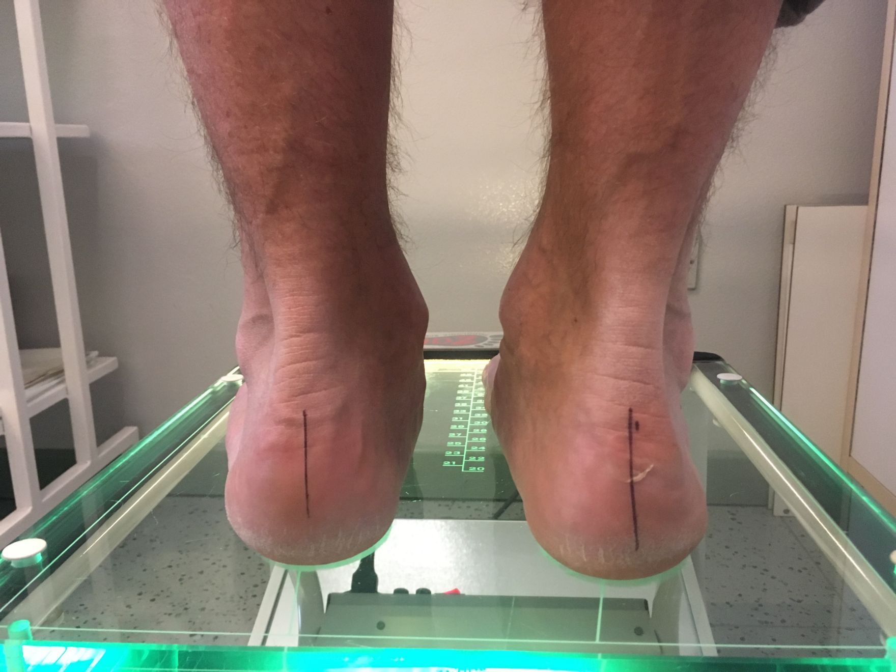 studio del piede per plantare su misura