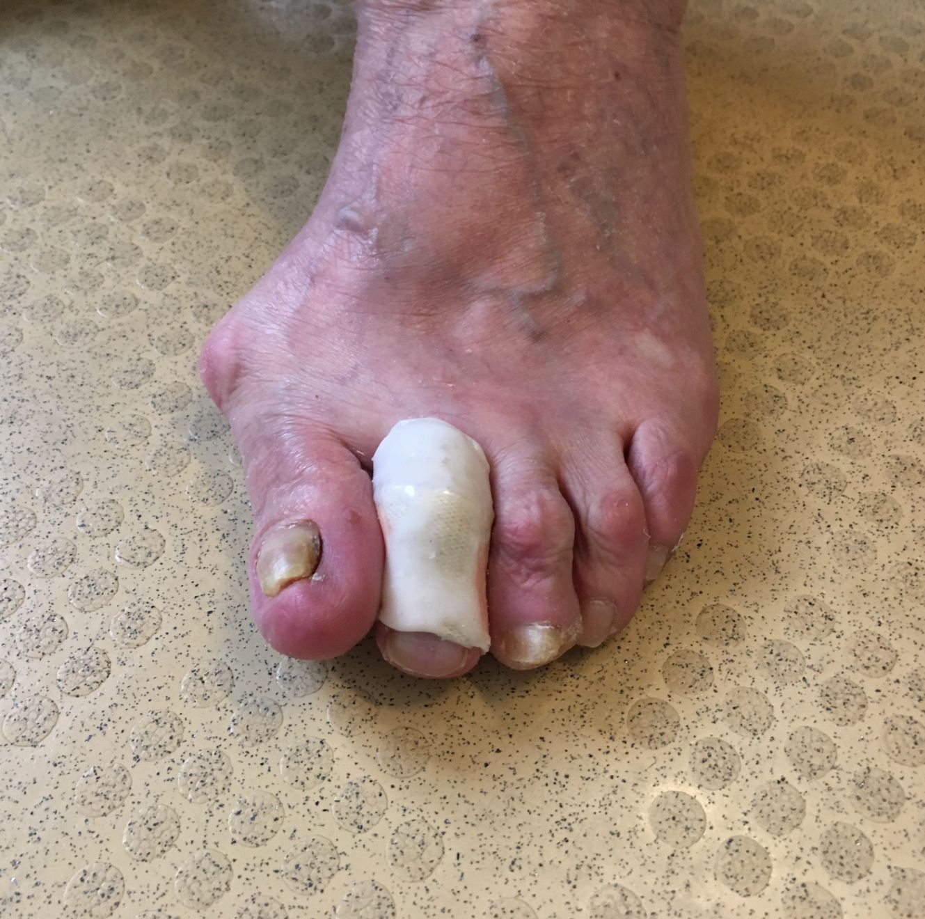 protezioni per dita dei piedi