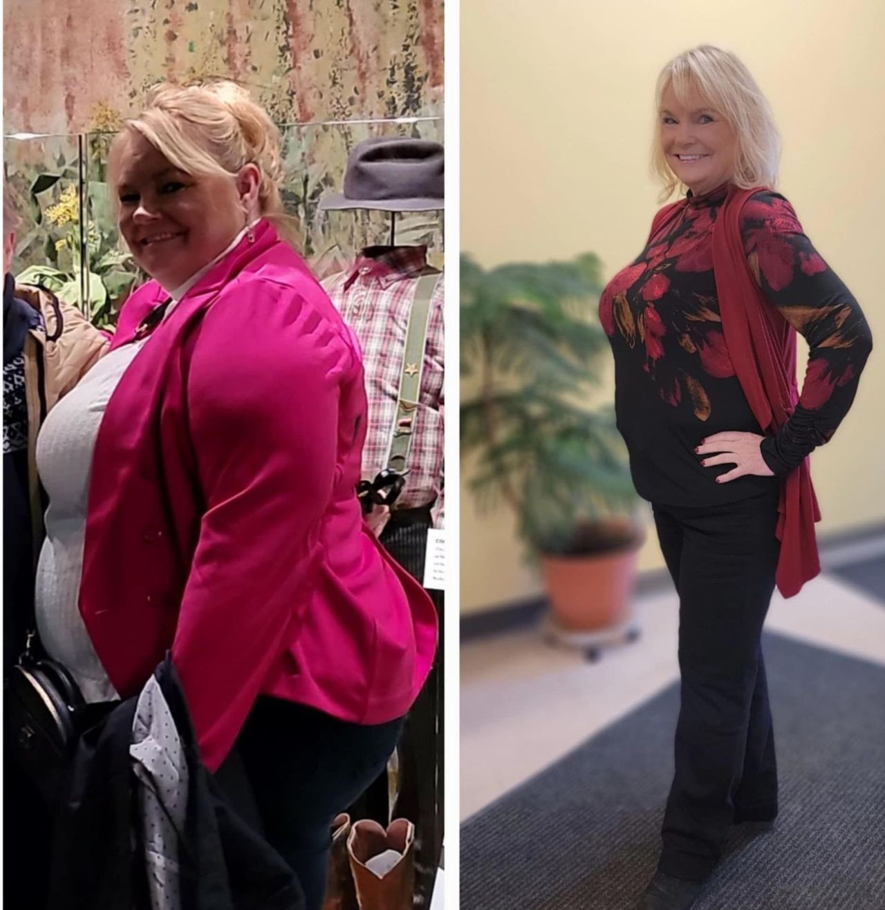 how to cycle semaglutide No more confusion — the semaglutide dose chart for weight loss is your  roadmap to a healthier you. Follow the right plan, see real results, and  transform your life. Start your journey