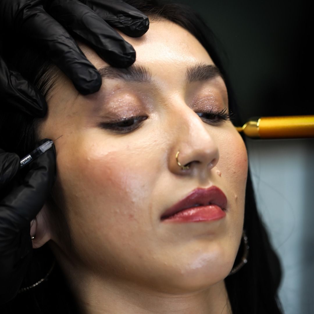 Person receiving facial cosmetic procedure; black-gloved hands hold tools near face.