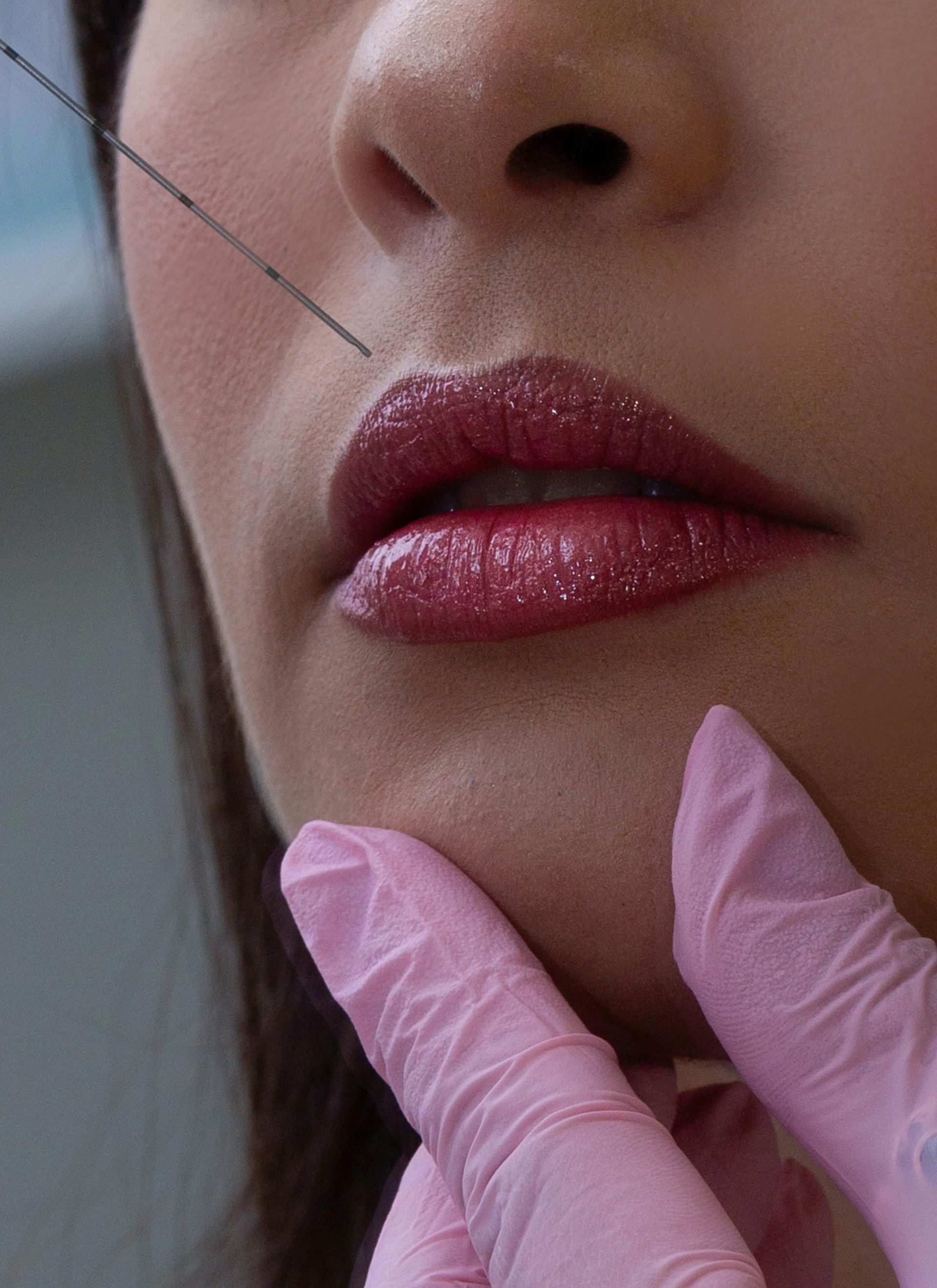 Needle injecting lip. Close-up of a person's lips with glossy red lipstick. Gloved hand.