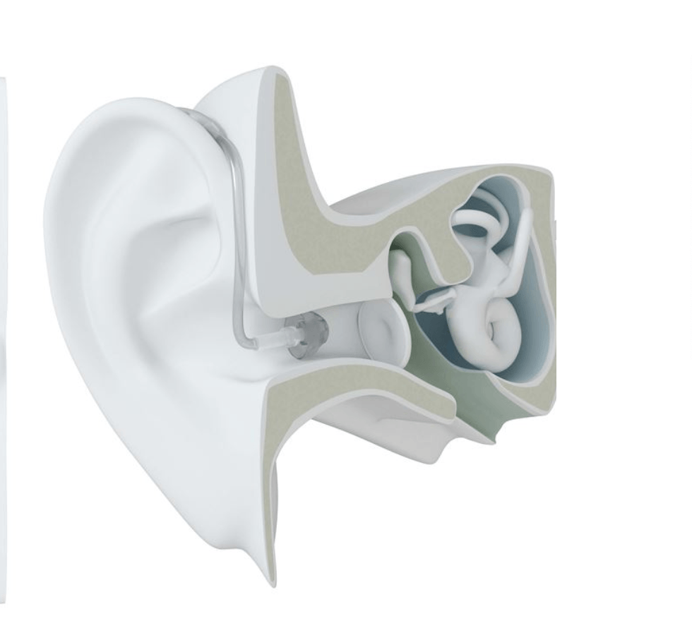 behind the ear hearing aids