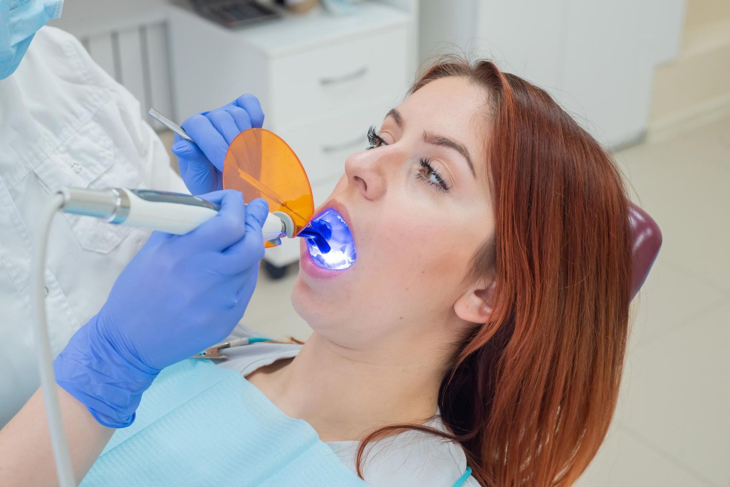 dental fillings