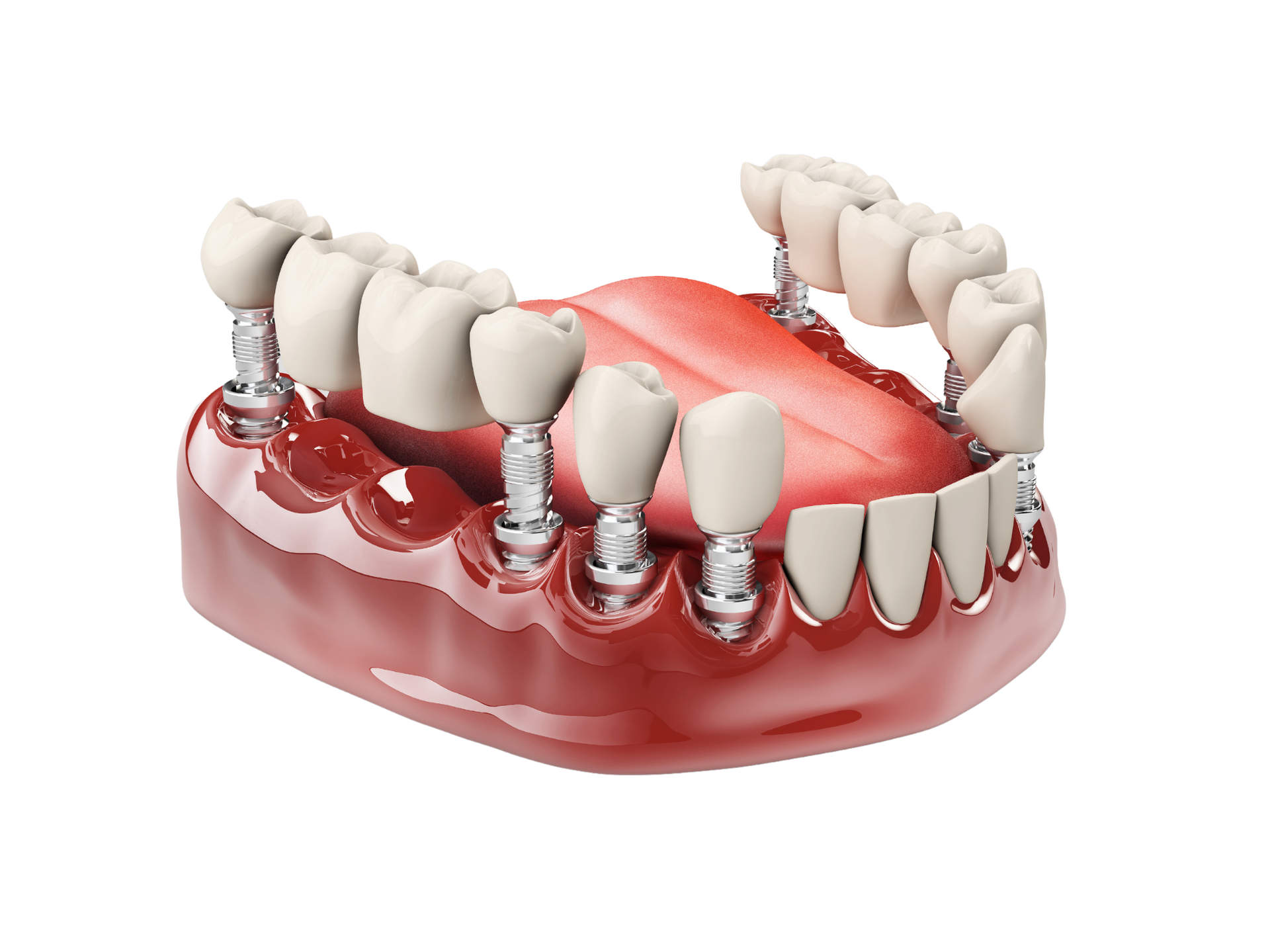 women smiling in the dental treatment room 