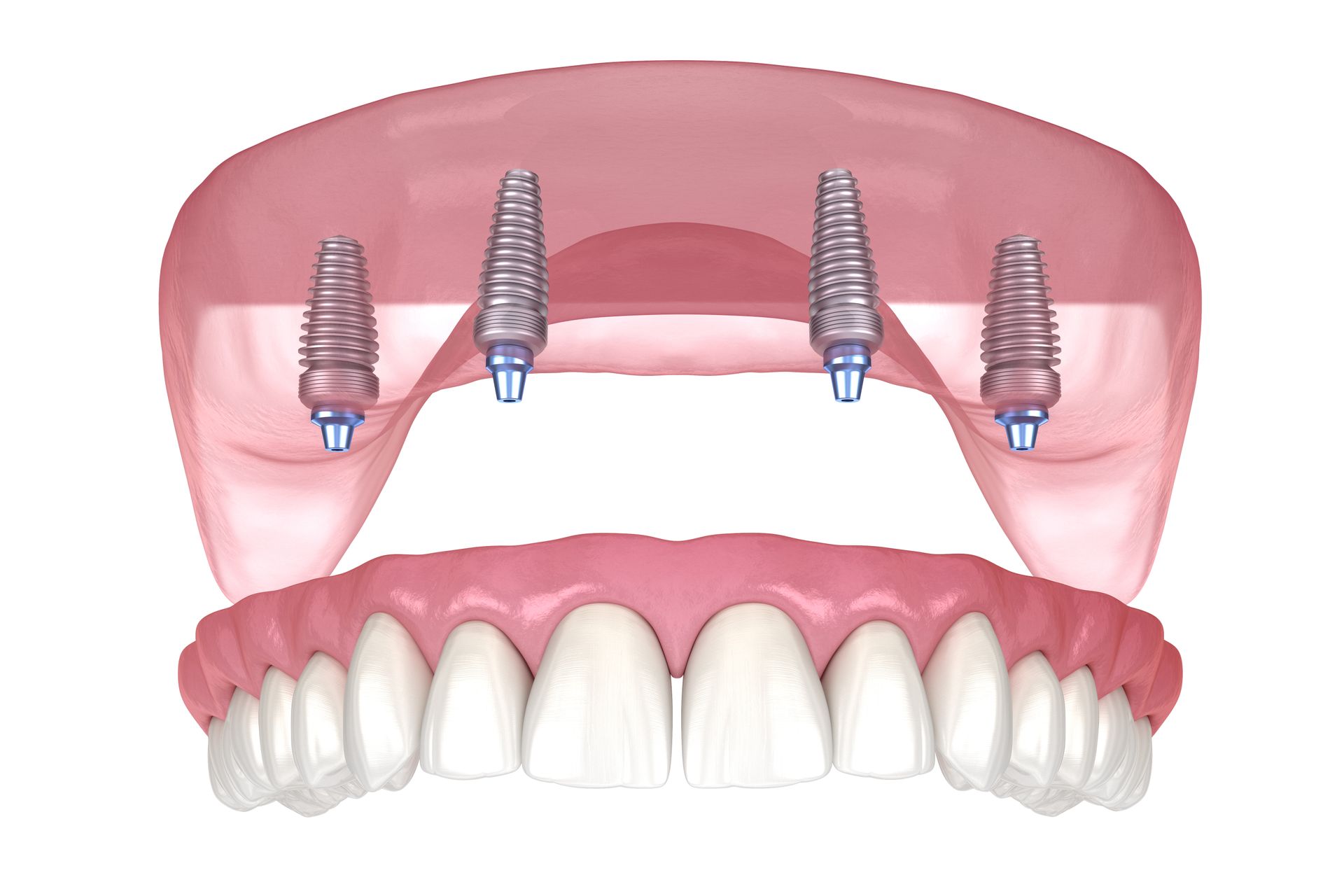 women smiling in the dental treatment room 