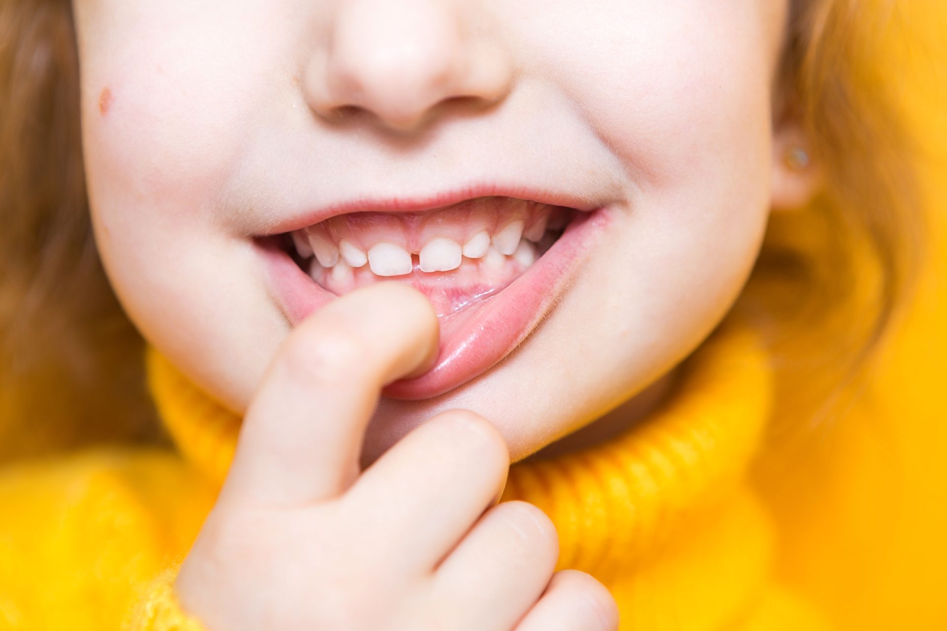 A person wearing a yellow sweater touches their lower lip with a finger while smiling to show their front teeth.