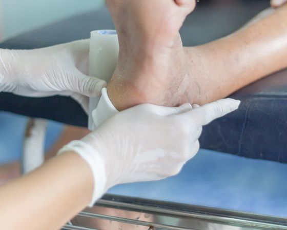 Foot Wound Care – Infected Wound in West Chester, PA