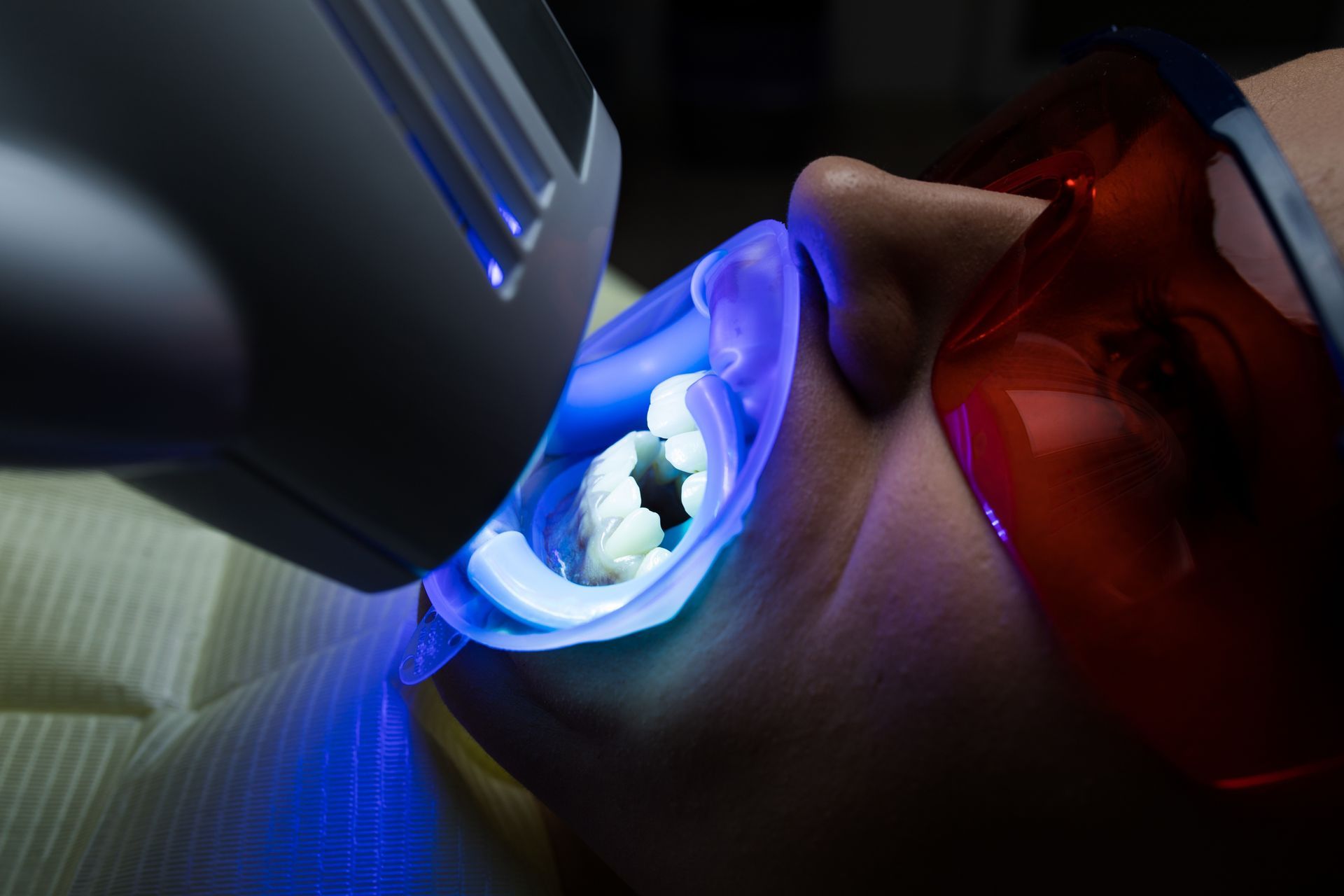 Person undergoing teeth whitening treatment with a blue light; wearing protective eyewear and mouth retractor.
