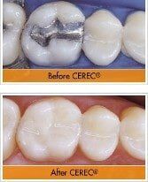 Before and After — Dentist in Katy, TX