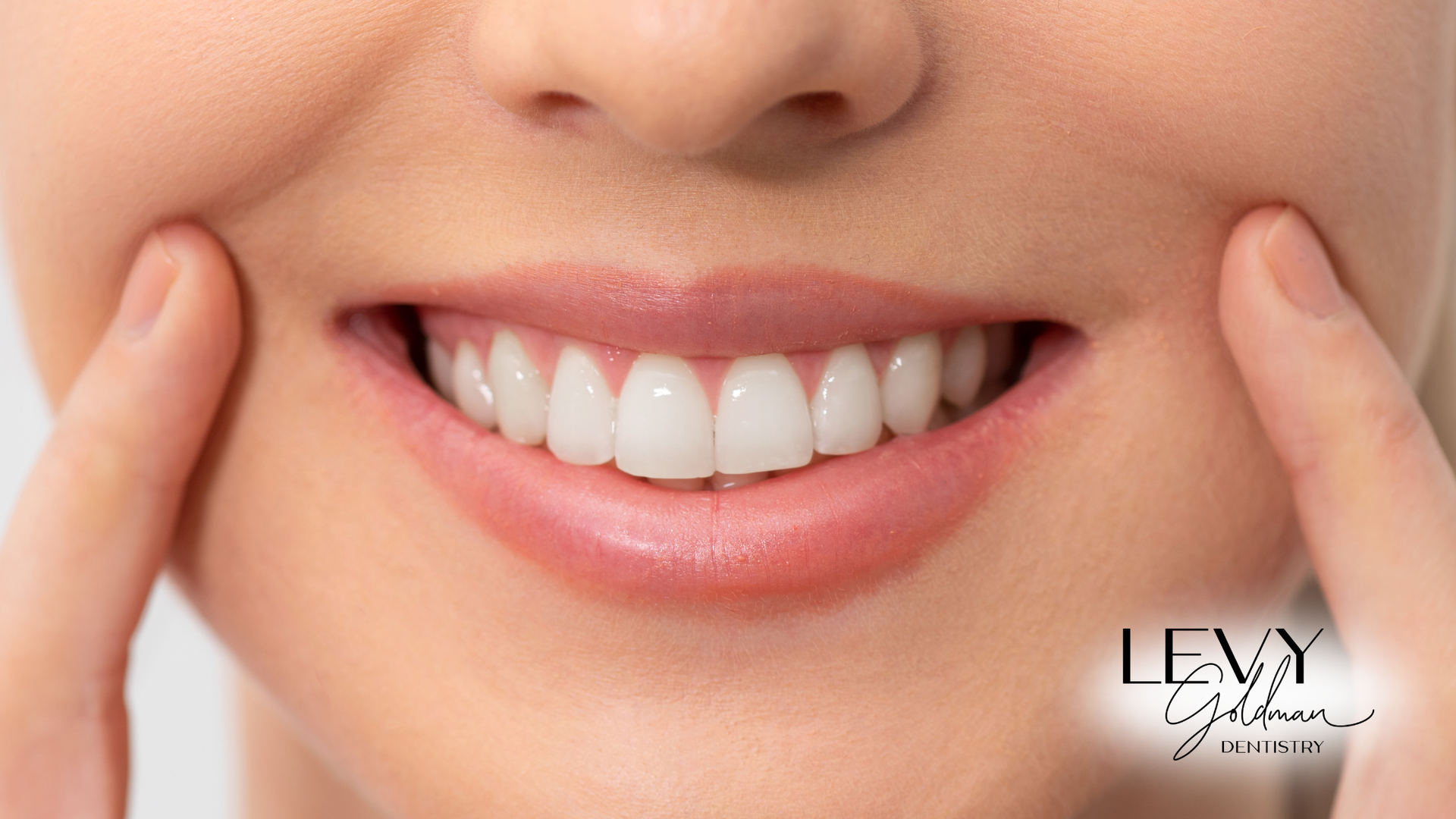 Close-up of a person's smiling mouth. Fingers pull cheeks back, revealing bright, white teeth and pink lips.