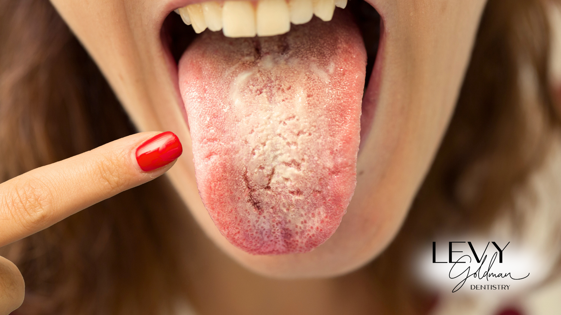 A woman with red nail polish is pointing at her tongue.