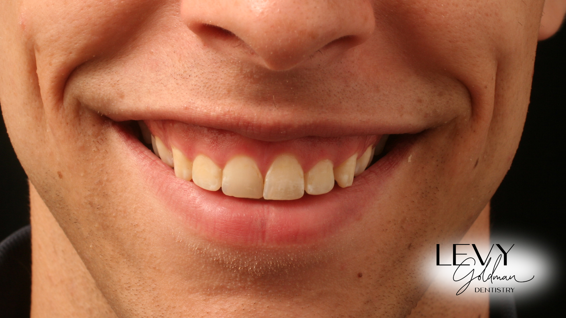 A close up of a man 's mouth with a smile on his face.