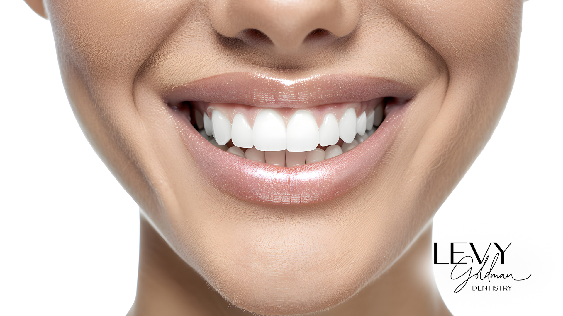 Close-up of a smiling mouth with bright white teeth and glossy, light-colored lips.