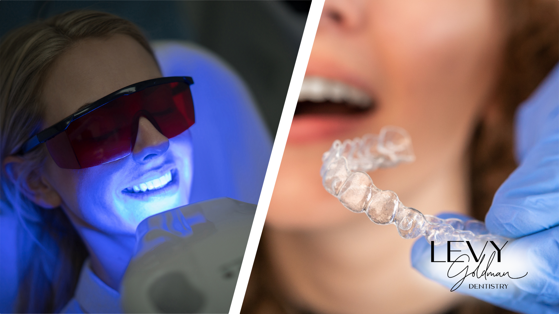 A woman is getting her teeth whitened and a woman is getting her teeth whitened.