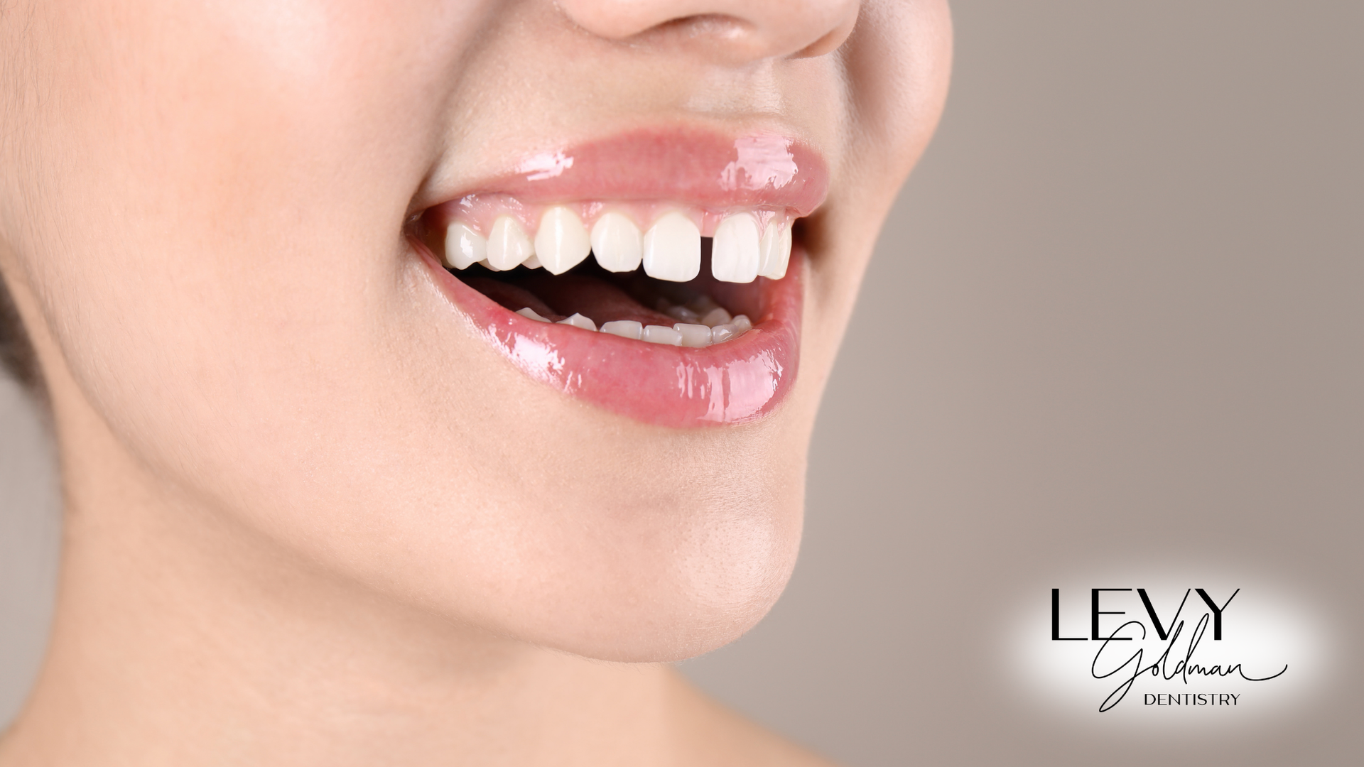 A close up of a woman 's teeth with her mouth open.