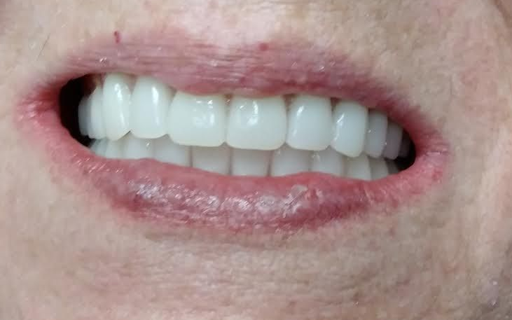 Smile Gallery