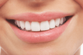 Dental services - London - Batman Dental - Smile