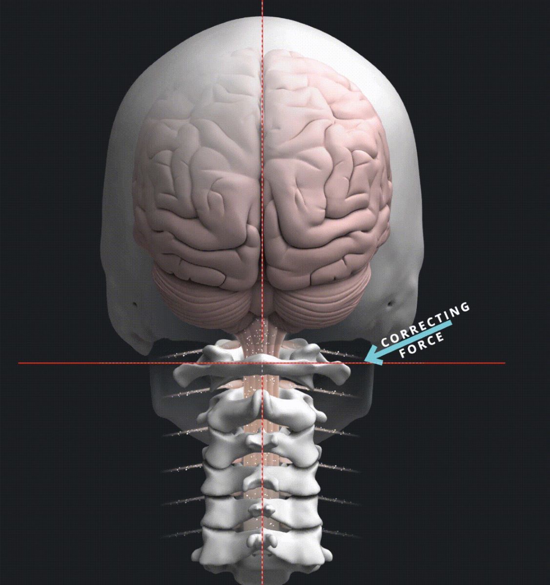 A computer generated image of a skull and brain with the words correcting force below it