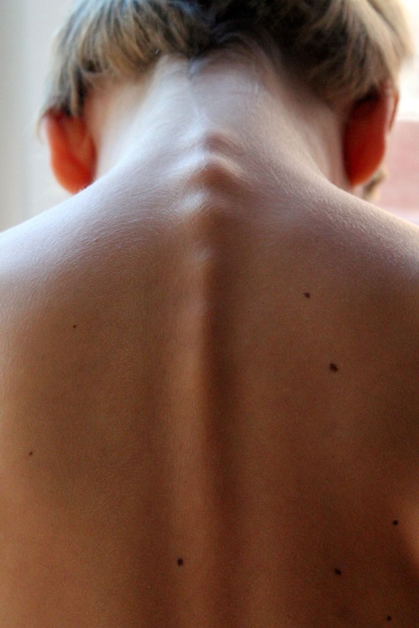 A close up of a person 's back with a slight curve in it.