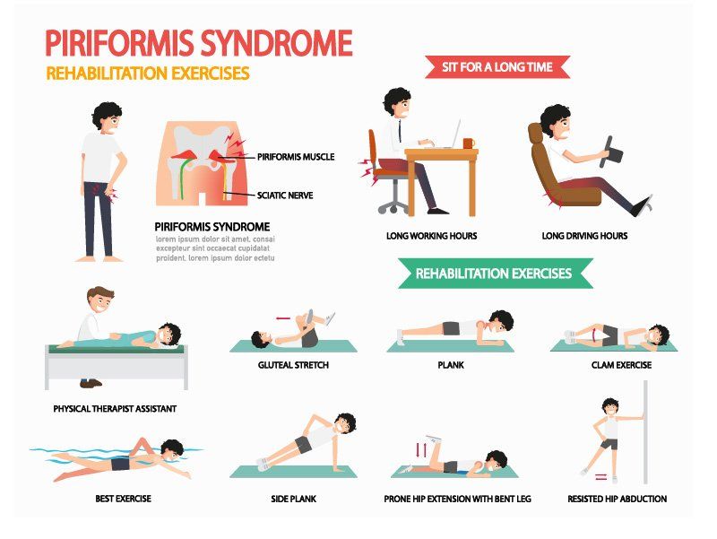 Piriformis Syndrome Exercises