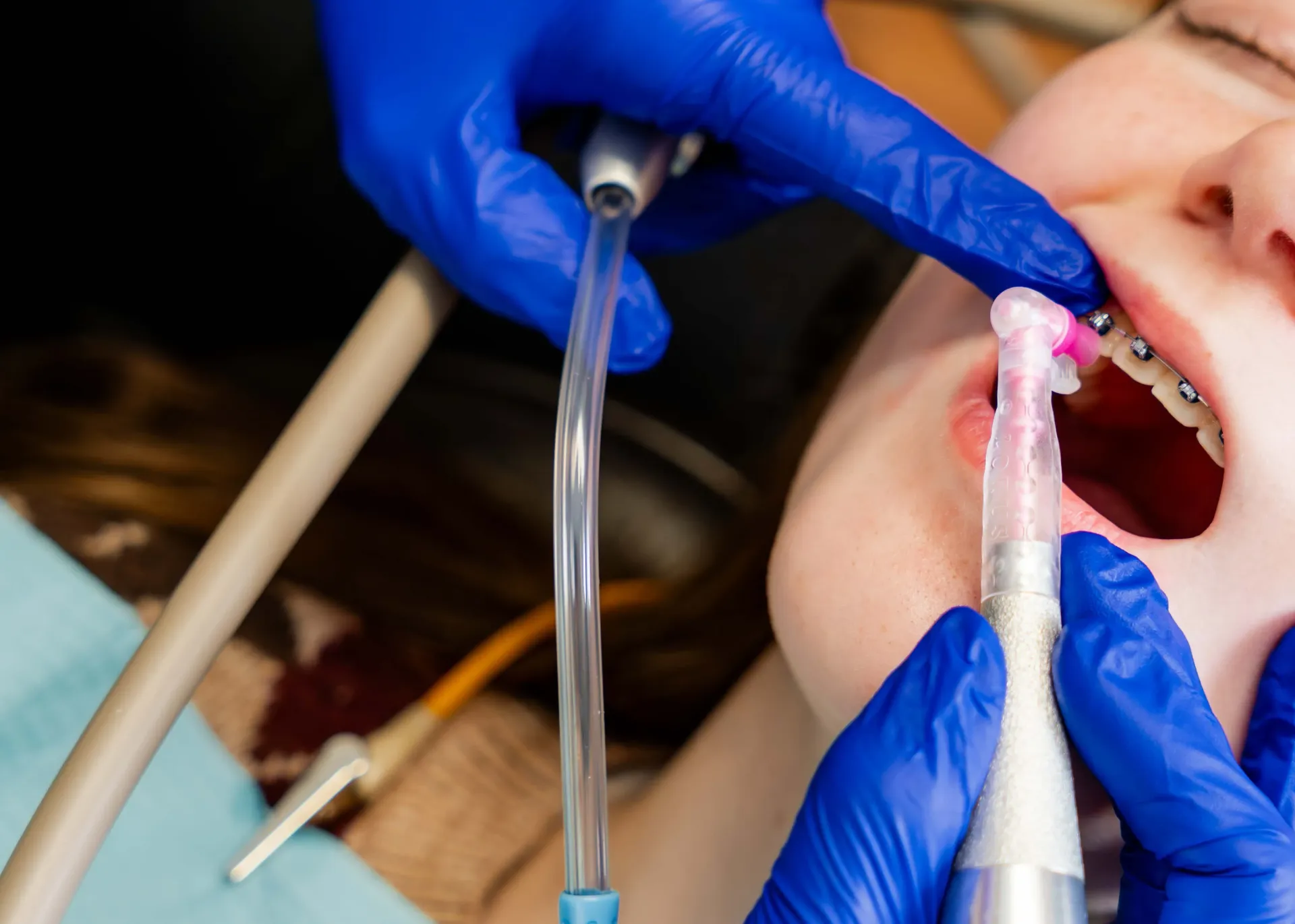 A dentist is looking through a microscope at a patient 's teeth.