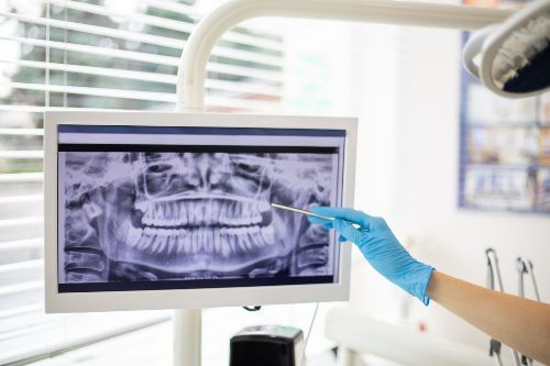 A dentist is looking at an x-ray of a person 's teeth on a computer screen.
