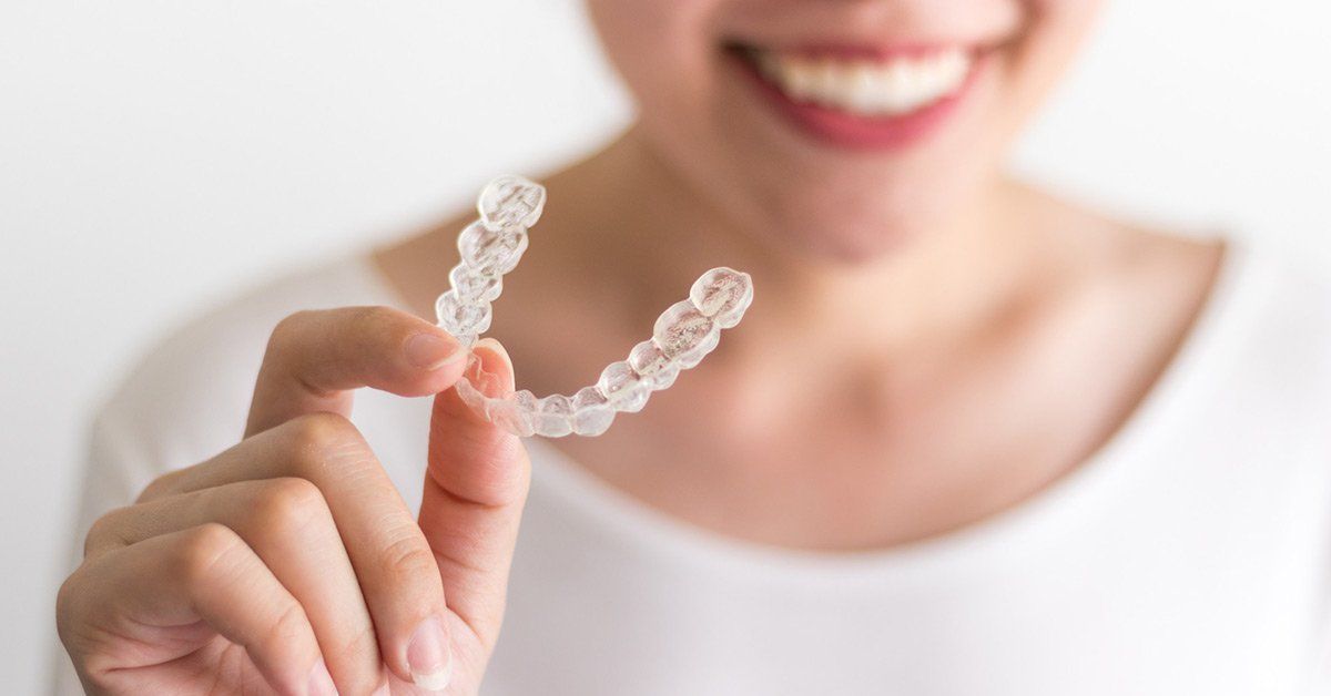 INVISALIGN REVIEW - everything you need to know 