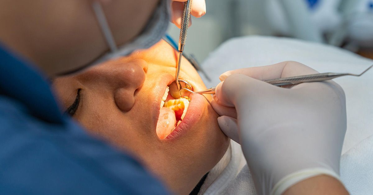 types of oral surgery