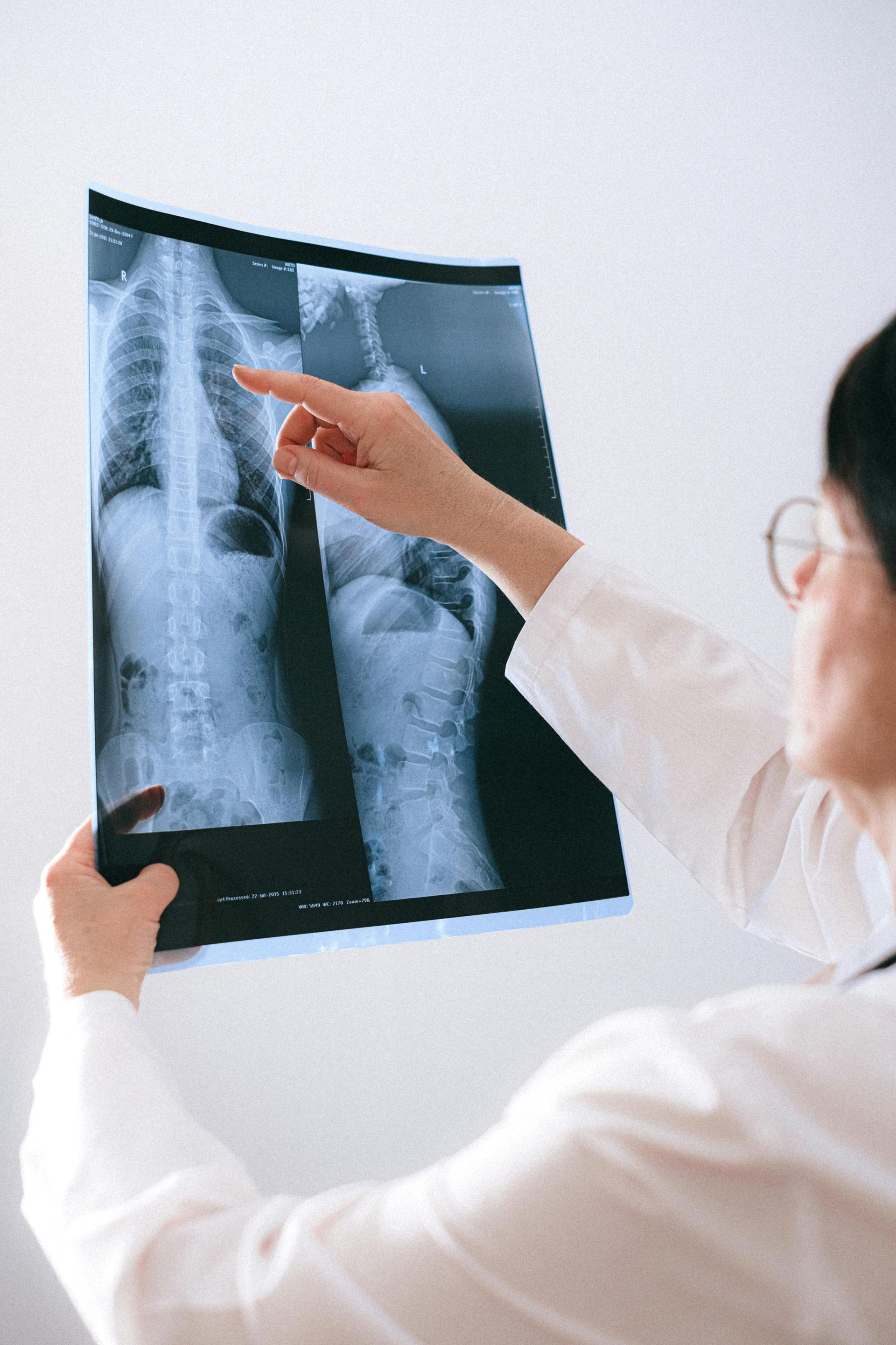 Radiografía, RX, ajuste quiropráctico, clínica quiropráctica, quiropráctico trabajando