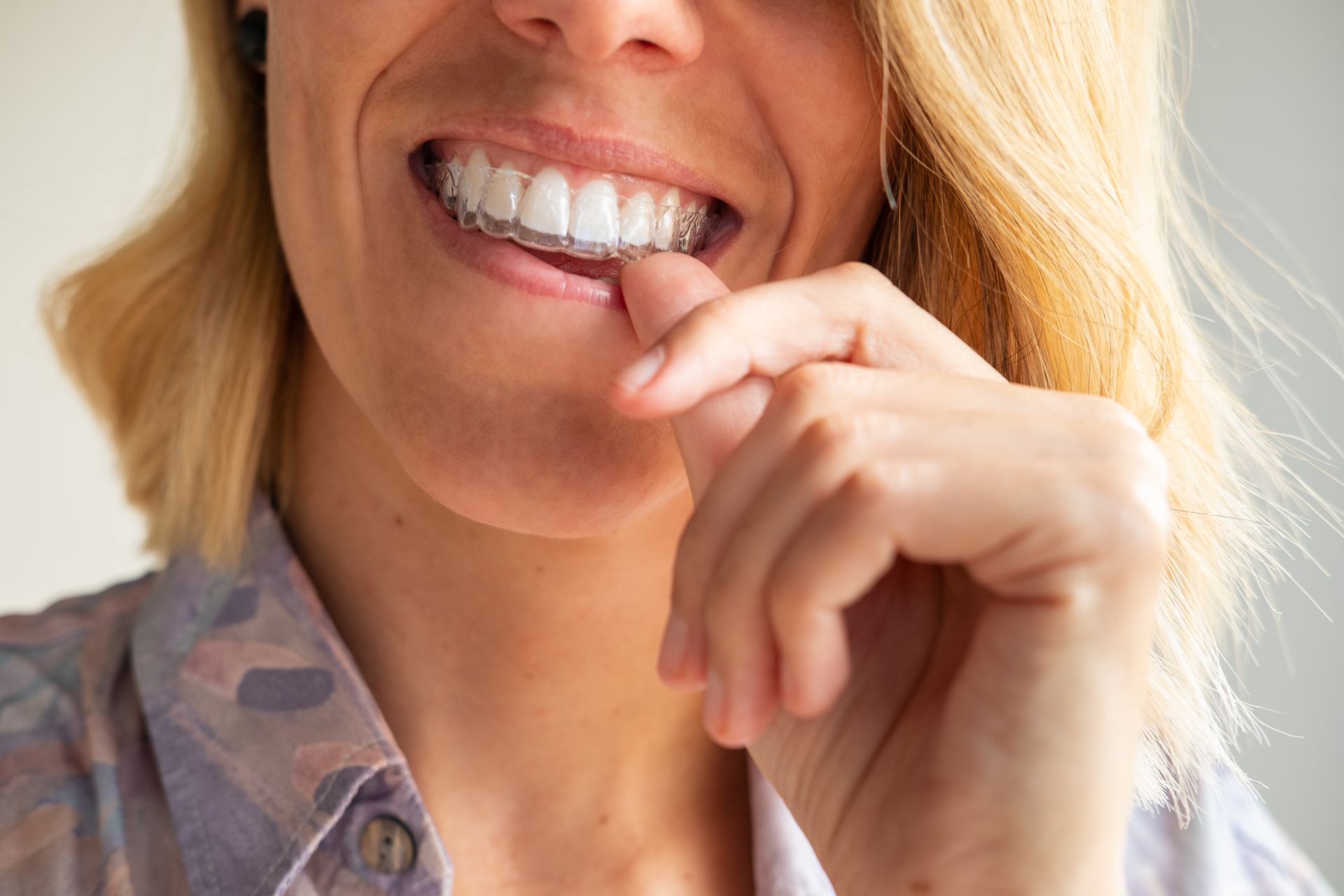 A close up of a woman 's mouth with braces on her teeth.