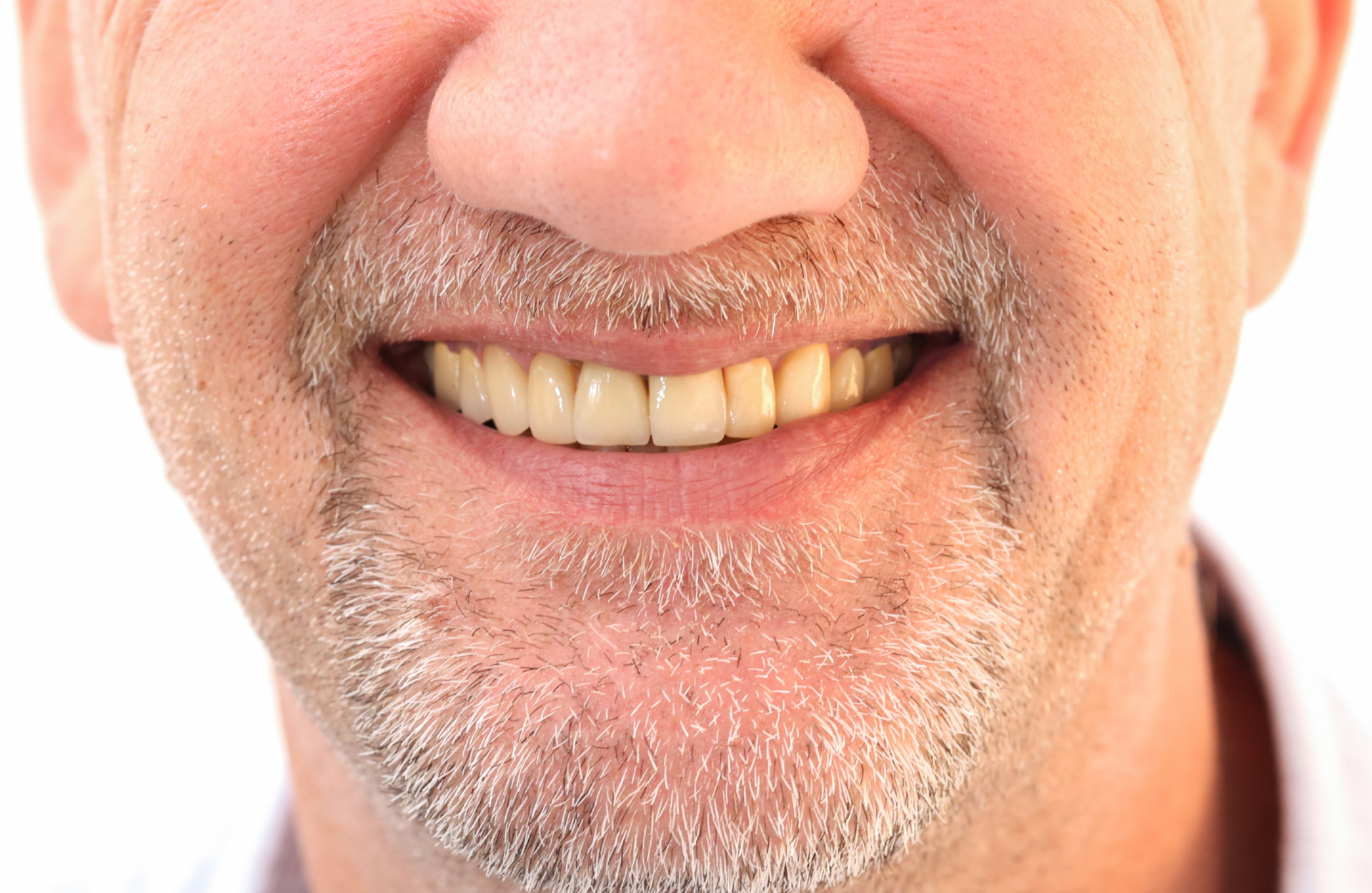 A close up of a man 's face with a beard and teeth smiling.