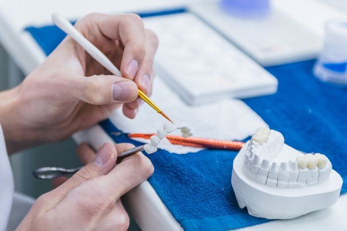 realizzazione di protesi dentarie