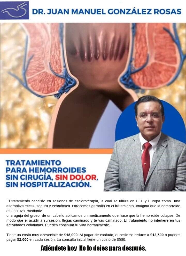 TRATAMIENTOS PARA HEMORROIDES
