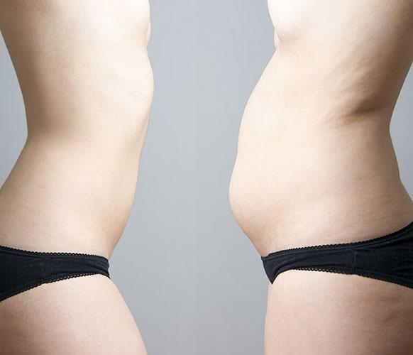 DR. JUAN MANUEL GONZÁLEZ ROSAS - HERNIAS