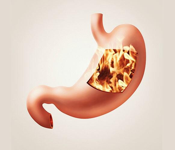 DR. JUAN MANUEL GONZÁLEZ ROSAS - GASTRITIS