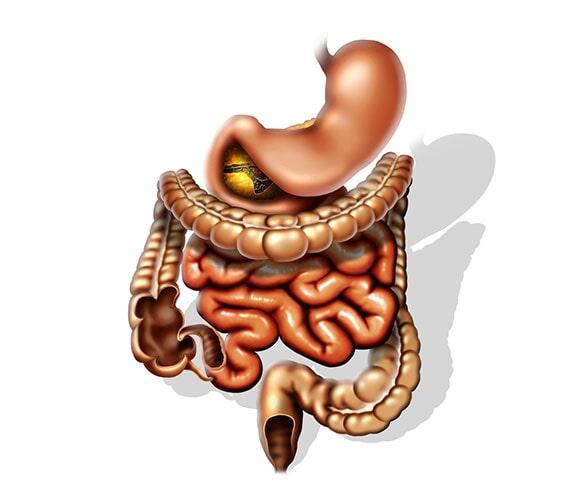 DR. JUAN MANUEL GONZÁLEZ ROSAS - REFLUJO