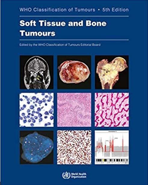 WHO classification of Tumours of Soft Tissue and Bone